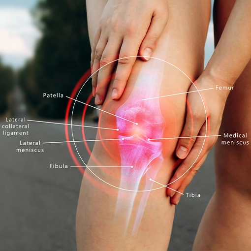 Knee Pain St. Louis MO Knee Pain Diagram