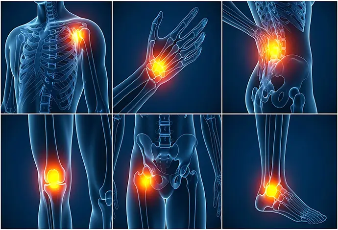 joint pain inflammation