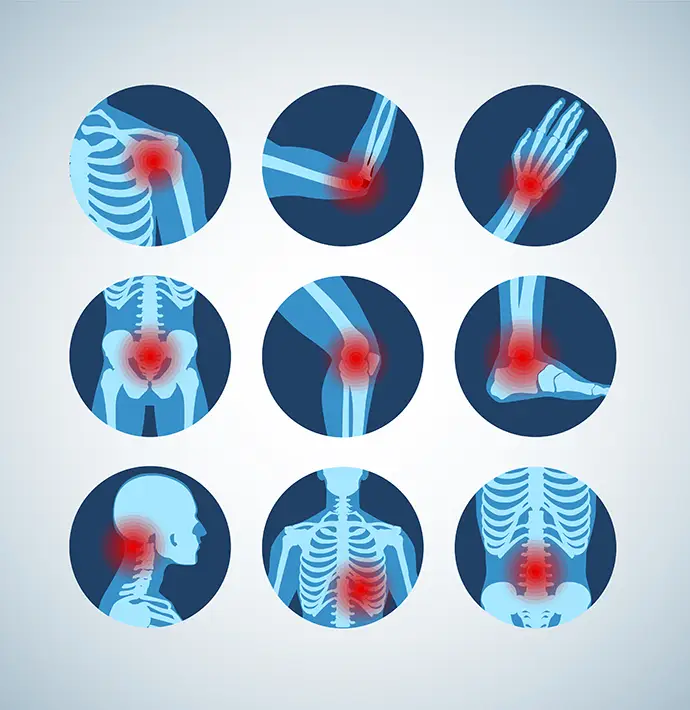 diagram showing different types of joint pain