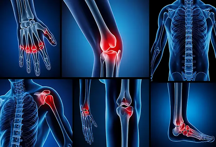 diagram showing different types of joint pain