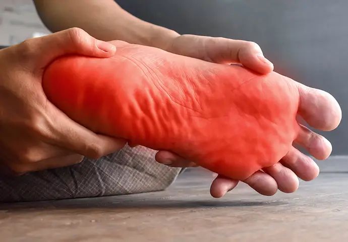 Tingling and burning sensation in foot of young man with neuropathy