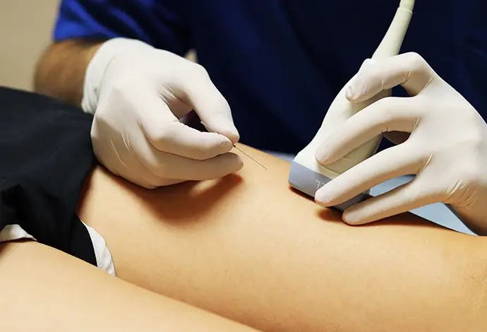 close up of doctor using ultrasound to determine where to apply the neuromodulation technique to patient's leg at Saint Louis Pain Center